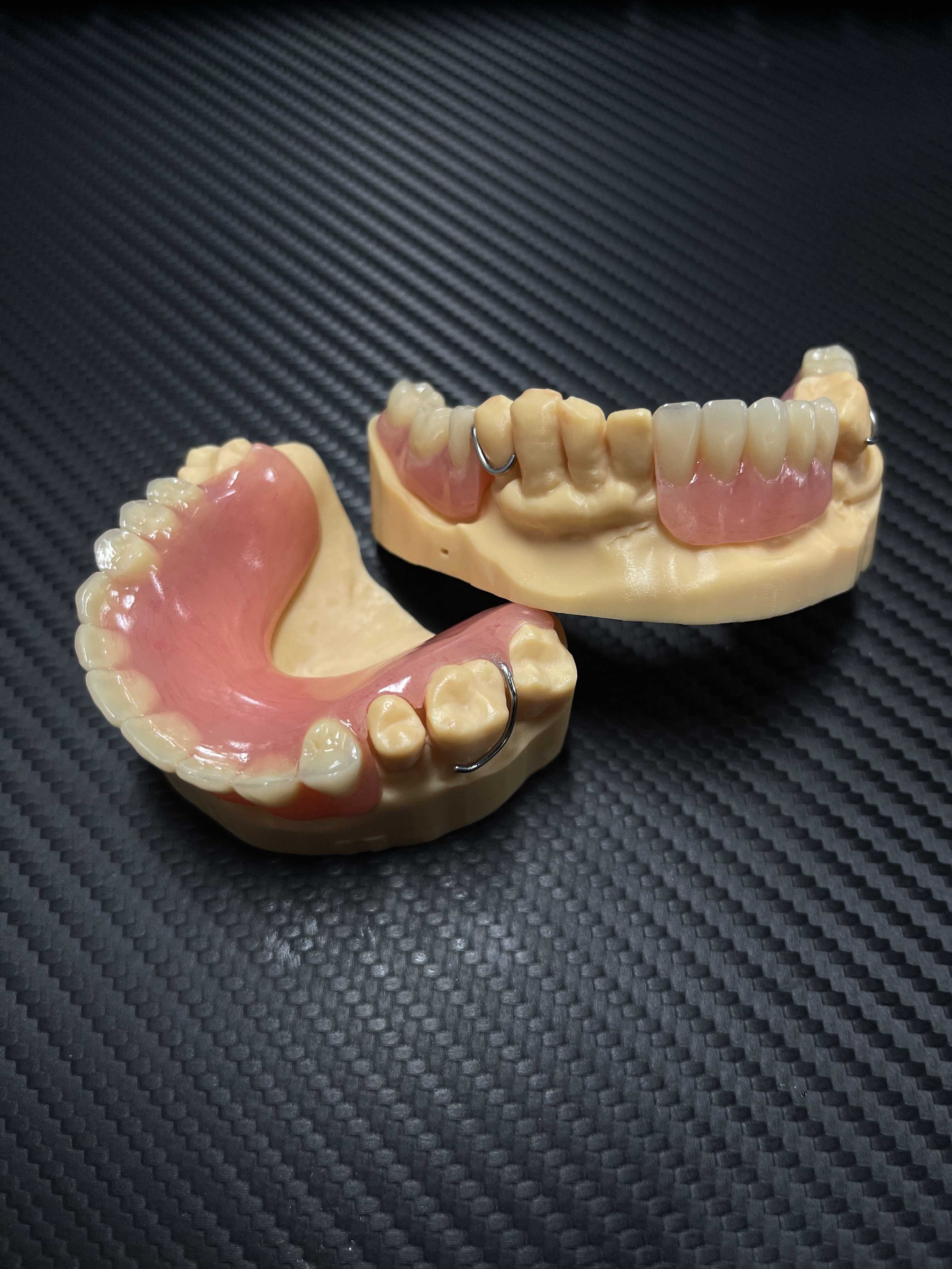 Partial Denture
