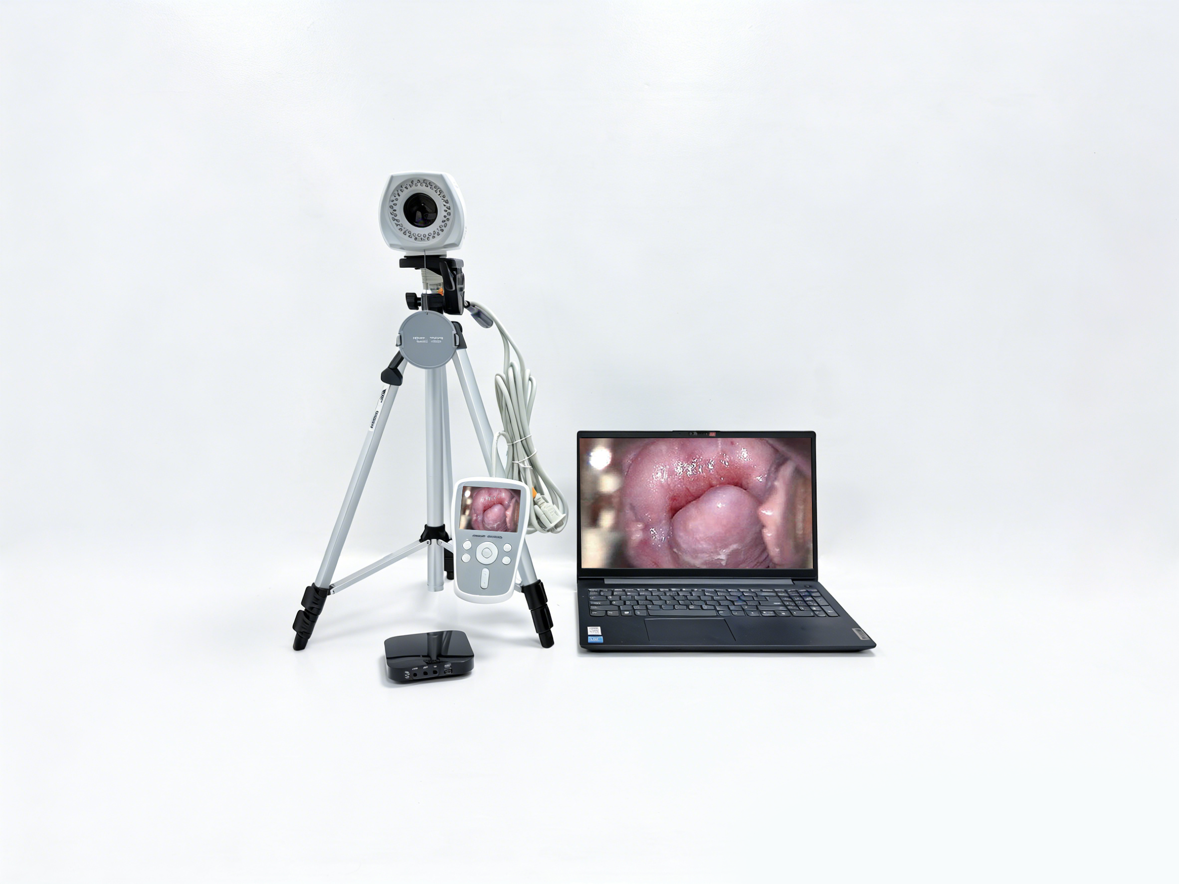 阴道镜EK-6000BL-1