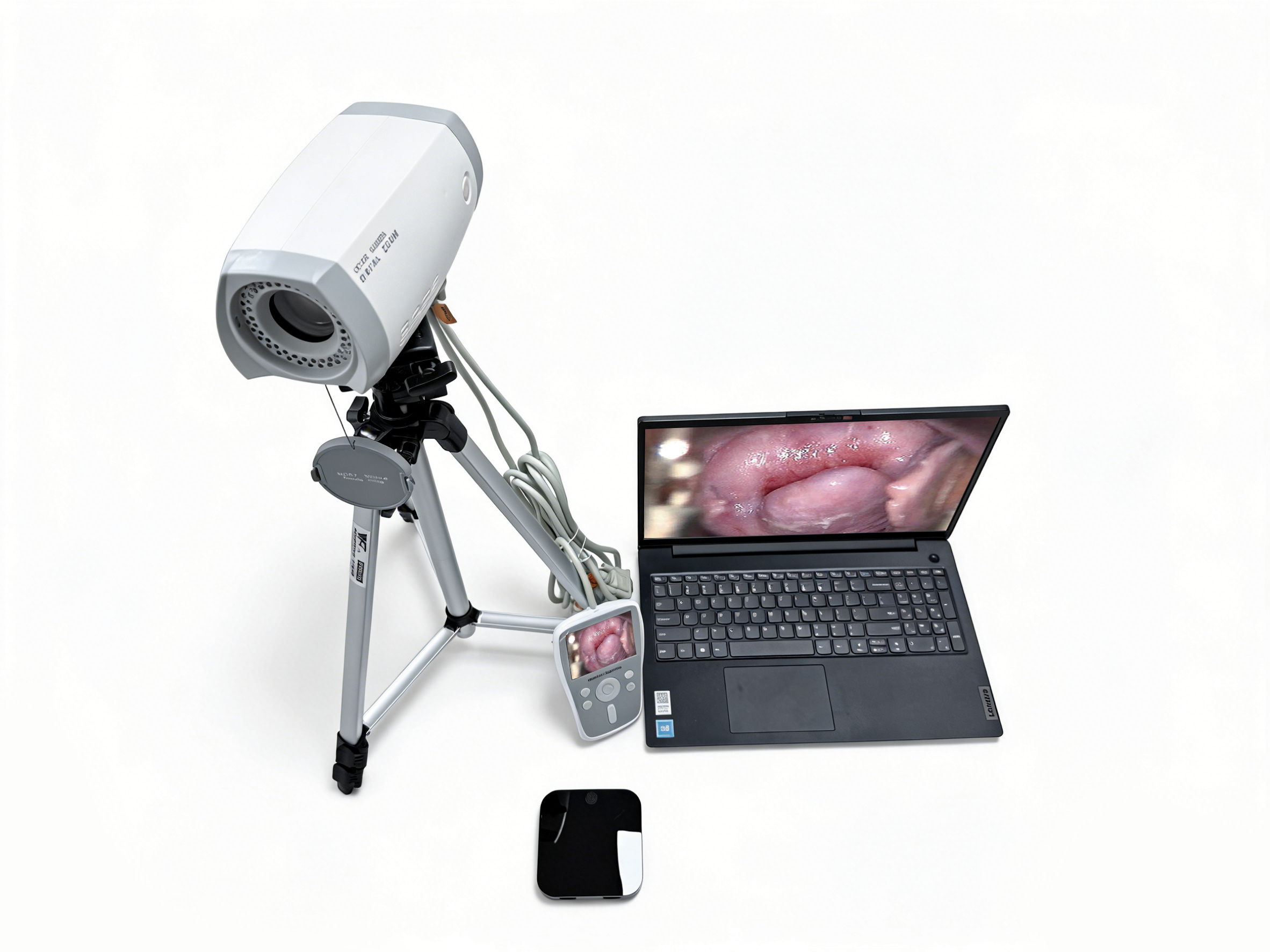 阴道镜EK-6000BL-2