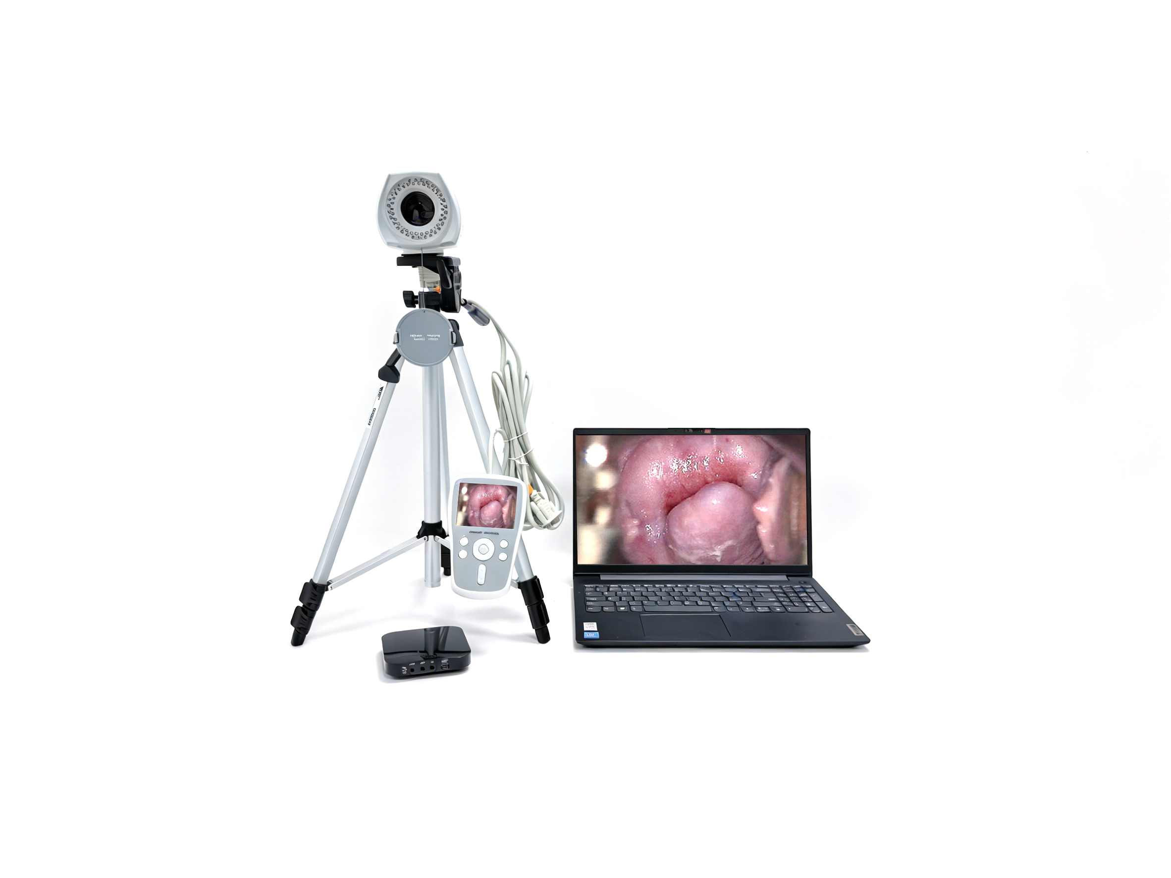 阴道镜EK-6000BL-1