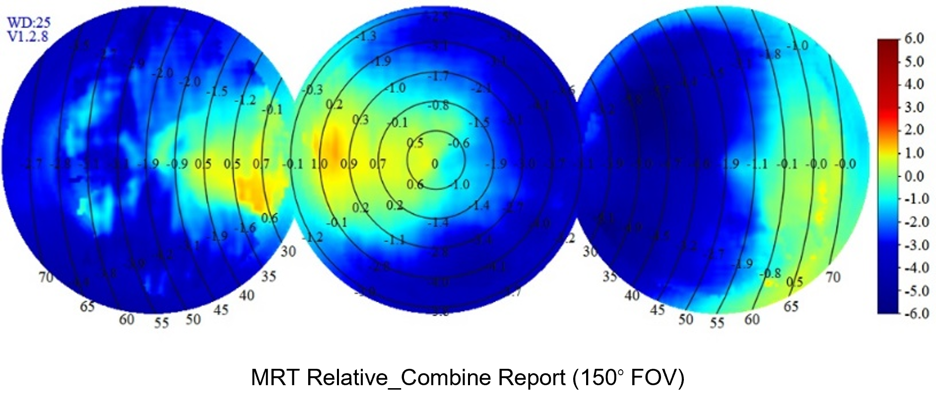 A typical wide-angle MRT image of a child wearing OK lenses, with the detection range extending from 53 degrees to 150 degrees.