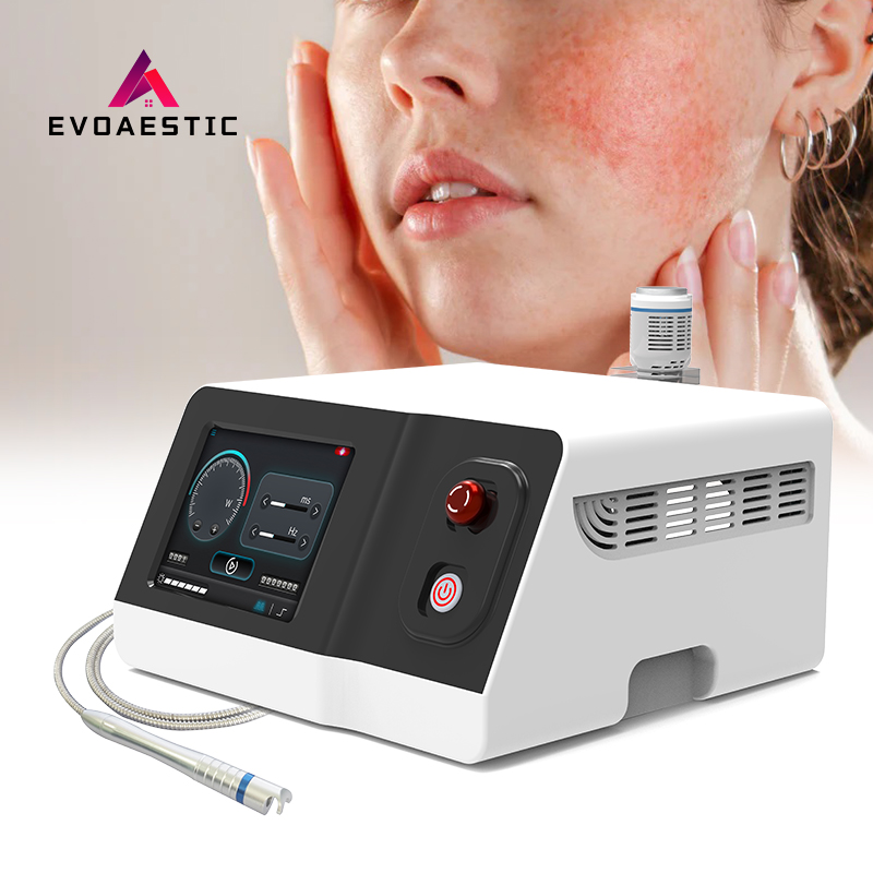 980nm Laser Spider Vein Removal