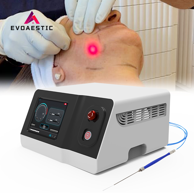 980nm 1470nm Endolaser Lipolysis Liposuction Laser